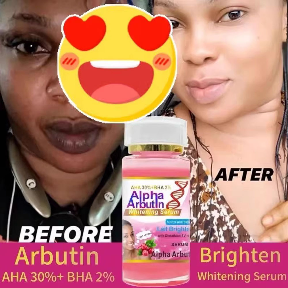 Alpha Arbutin Serum AHA 30%+ B - Alpha Arbutin Serum recensie en prijs
