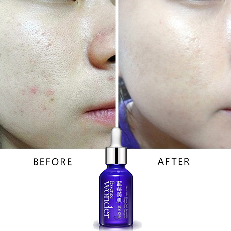Bioaqua Blueberry Gezicht Lift - Skincare Bioaqua recensie en prijs