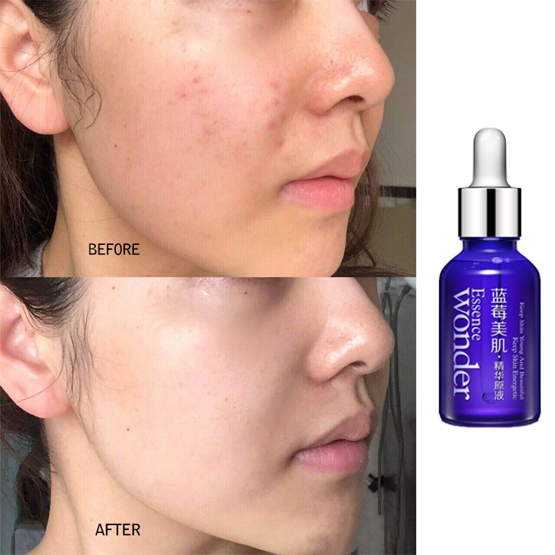 Bioaqua Blueberry Gezicht Lift - Skincare Bioaqua recensie en prijs