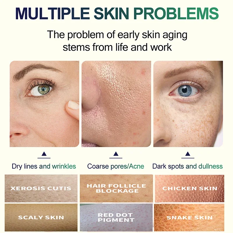 2e Salicylzuur Gezichtspeeling - Glycolic Acid Exfoliant recensie en prijs