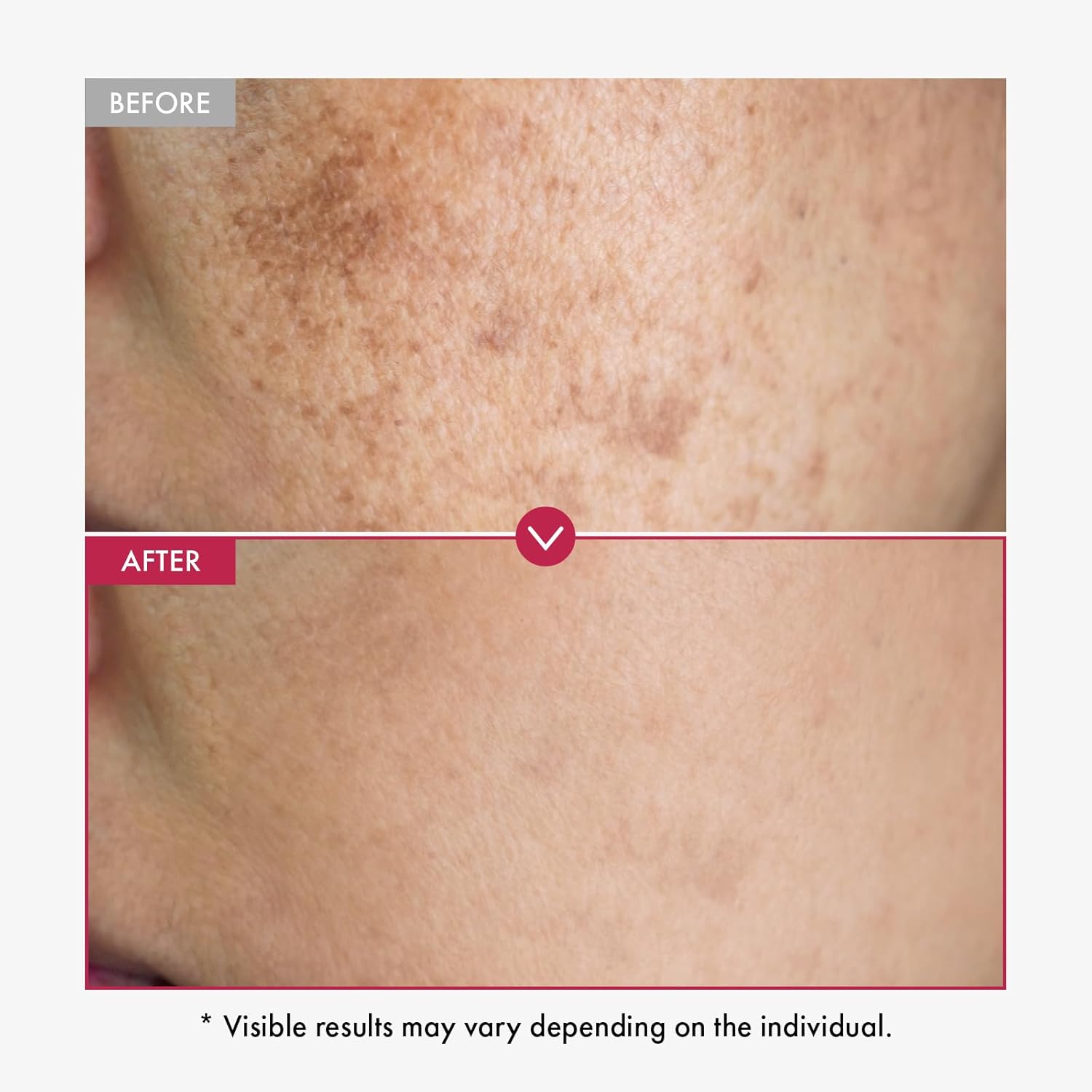 Alpha Arbutine Serum AHA Houdt - Alpha Arbutin Serum recensie en prijs