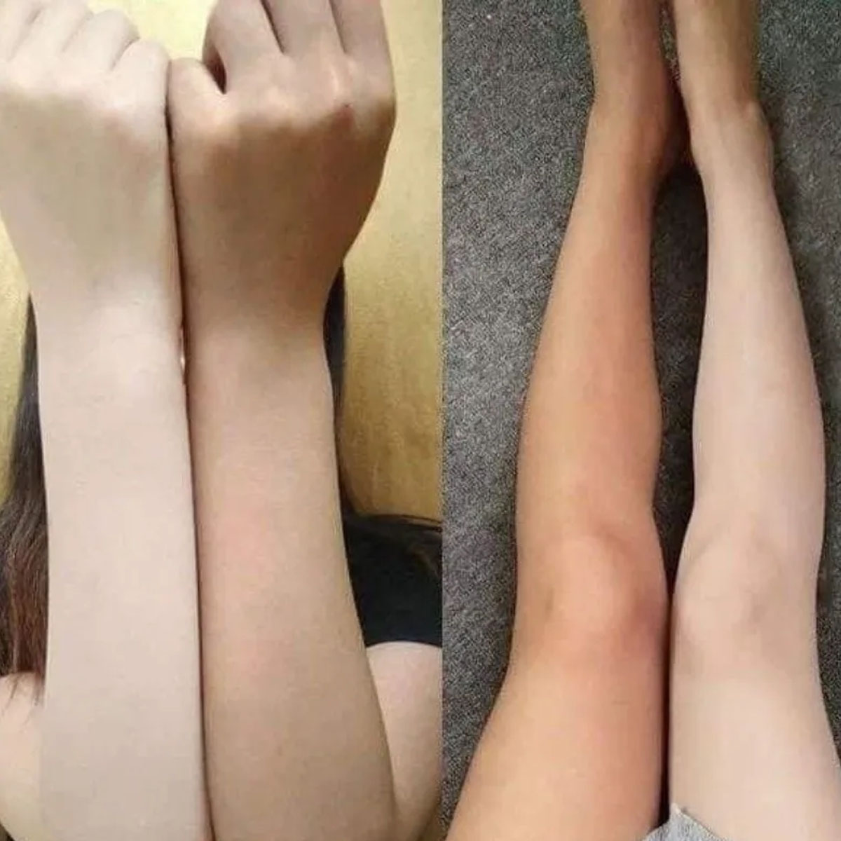 バng Serum ien Da Alpha Arbutin - Alpha Arbutin Serum recensie en prijs