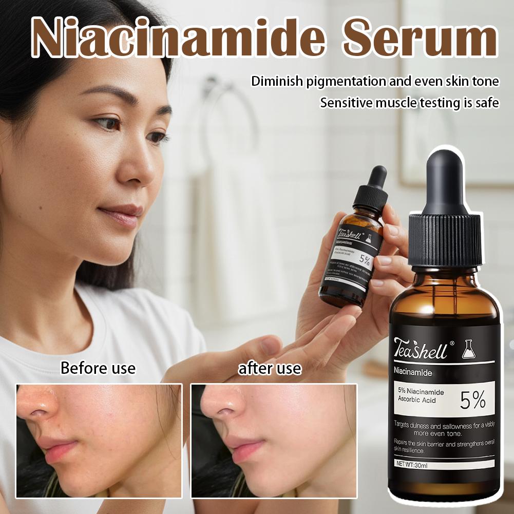 30ml Niacinamide Verhelderende - Alpha Arbutin Serum recensie en prijs