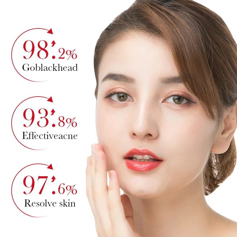 BIOAQUA Salicylzuur Acne Verwi - Skincare Bioaqua recensie en prijs