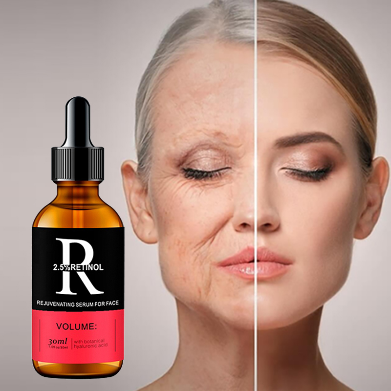 Gezicht Serum Huidverzorging V - Glycolic Acid Exfoliant recensie en prijs