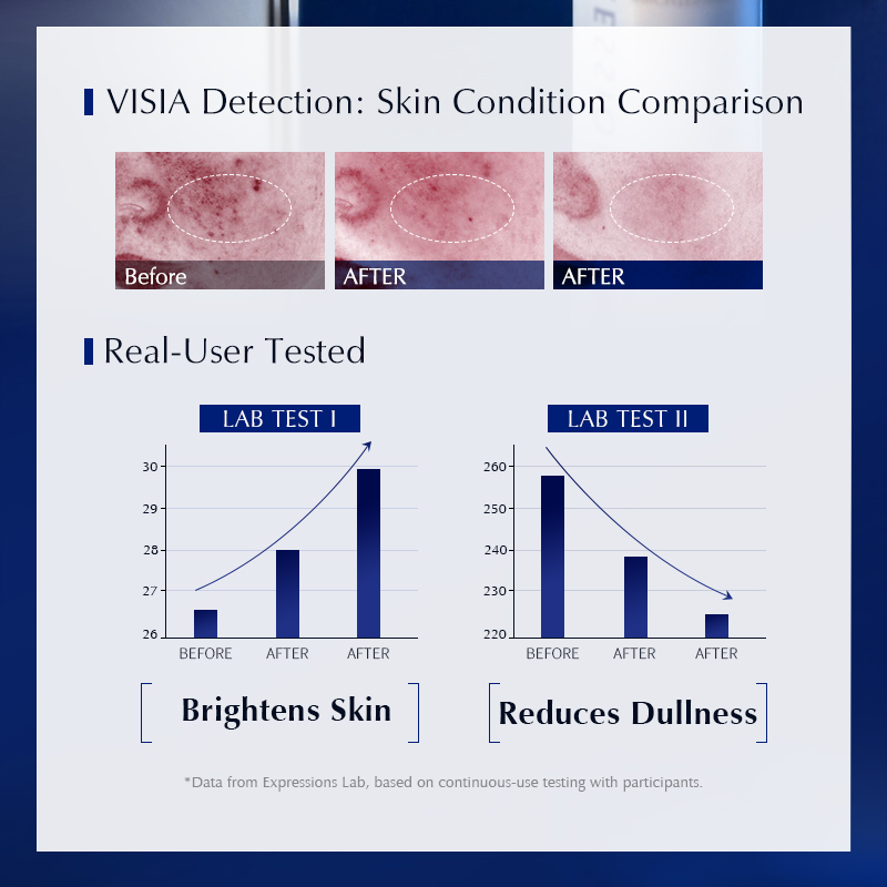 Verlichtende serum voor donker - Alpha Arbutin Serum recensie en prijs