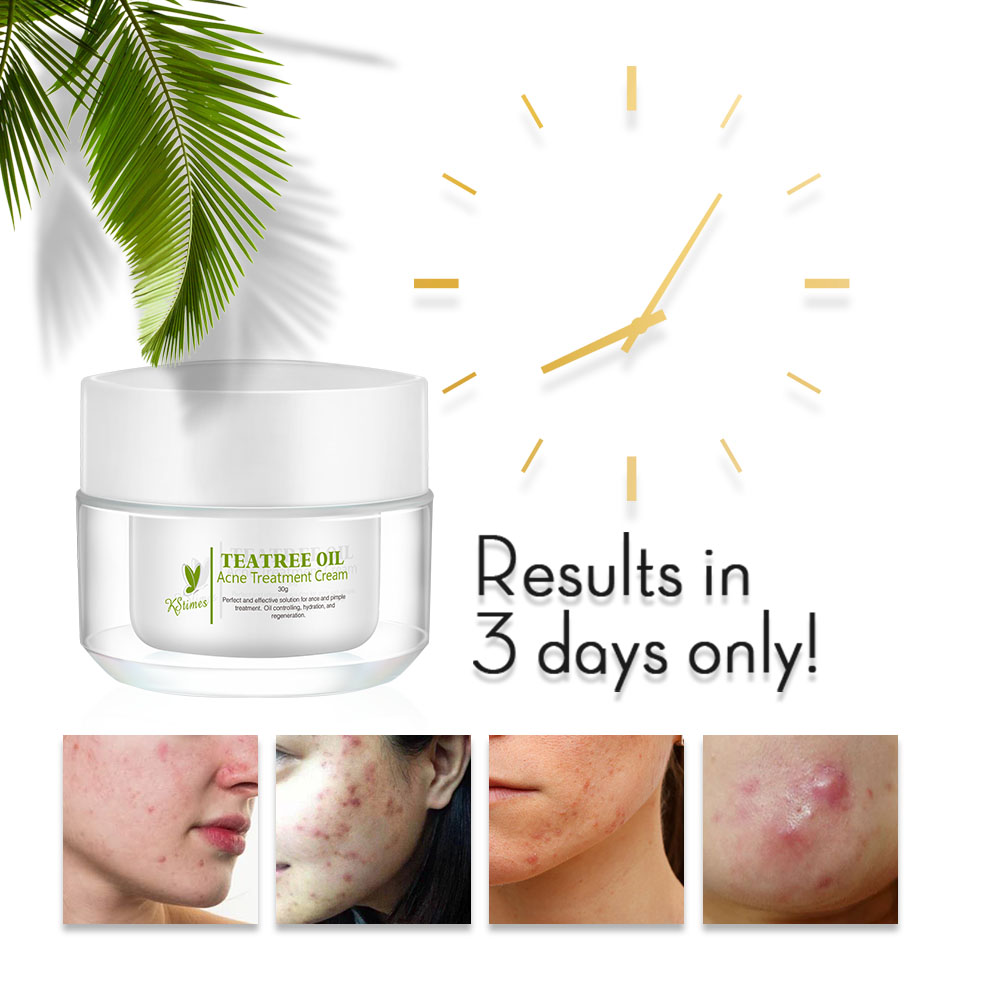 Kstims Natuurlijke Acne Behand - Tea Tree Spot Treatment recensie en prijs